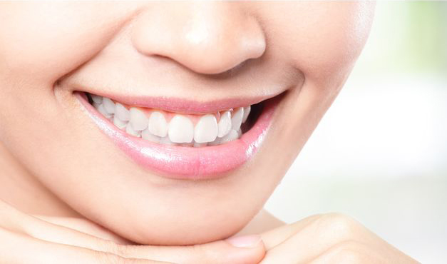 Despues de blanqueamiento dental